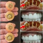 The Lemon-Charcoal Marvel: A Natural Solution for Everyday Needs